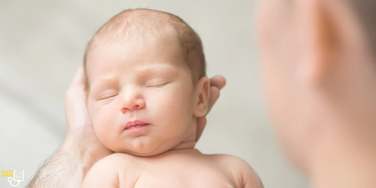 Grading of baby jaundice