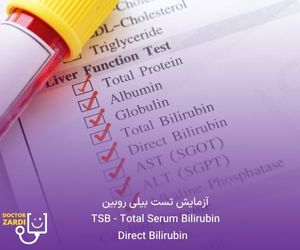 آزمایش زردی نوزاد (Direct Bilirubin ، TSB - Total Serum Bilirubin)